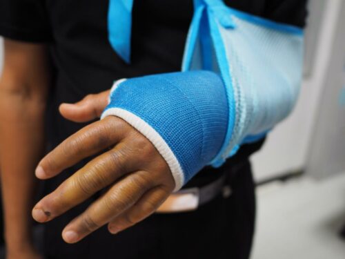 A person with an arm injury from a car accident.